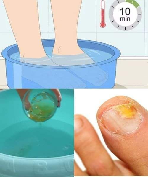 474949657 122182949048254616 2494968280066011324 n 1