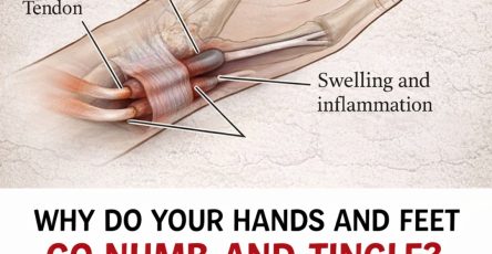 649677441 122298946742244907 4181472306051805978 n (1)