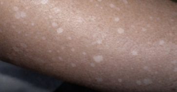 99bc0c92 2d4a 49da 8609 9c6d2add5ccb