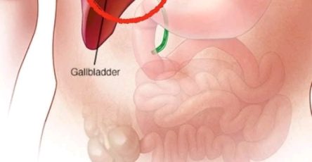 72734a1a 5280 4879 a377 8938cc1bc320